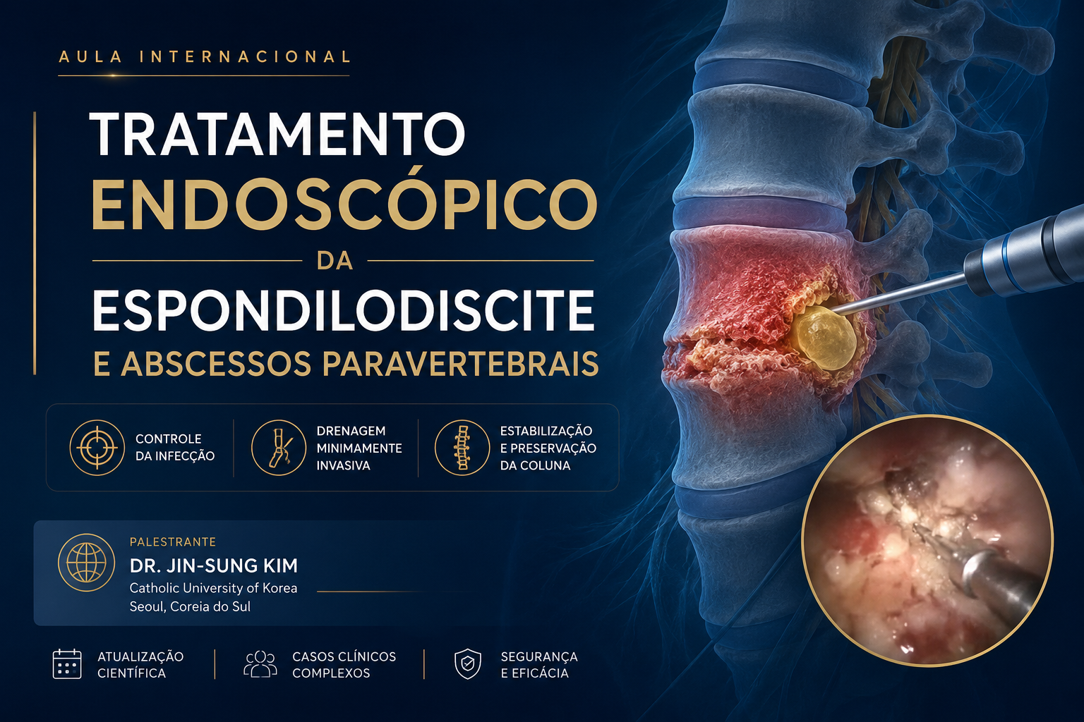 AULA: Tratamento Endoscópico da Espondilodiscite